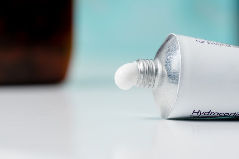 How Steroids Are Helpful in Alopecia Treatment? - WanderGlobe