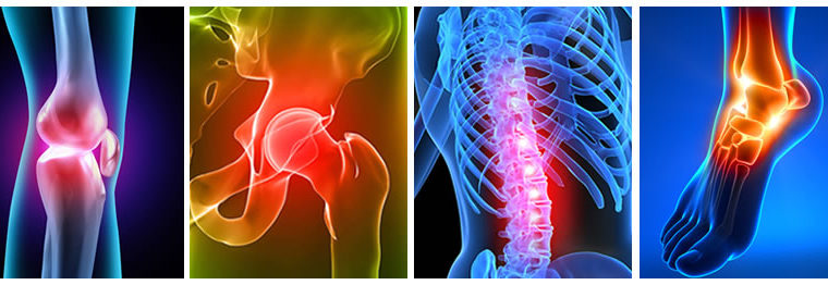 Fibromyalgia – Causes, Diagnosis and Treatment