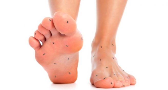 Top Natural Home Remedies For Neuropathy