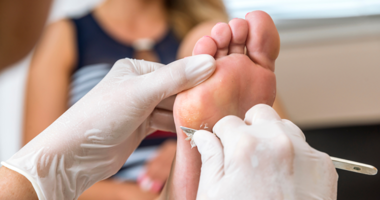 Why A Regular Visit to The Foot Clinic is Important?