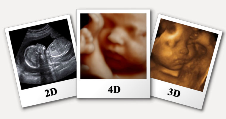 How Much Do You Know about Gynecology 2D, 3D And 4D Ultrasound Scan