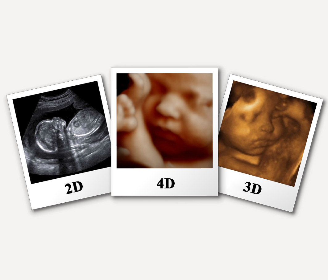 How Much Do You Know about Gynecology 2D, 3D And 4D Ultrasound Scan