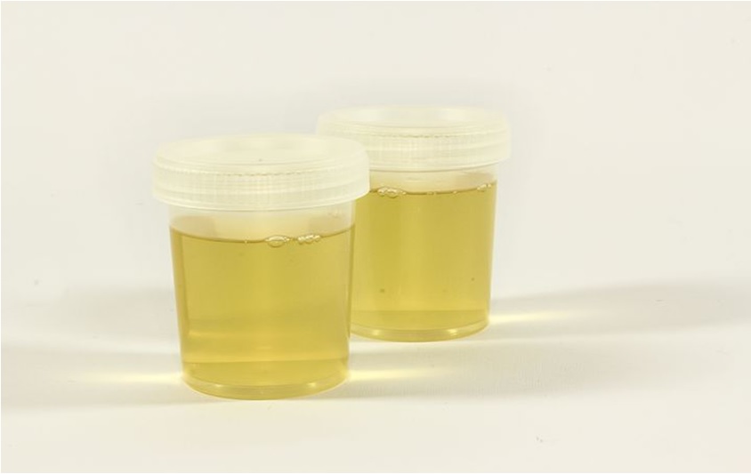 Urinalysis for Drug Testing