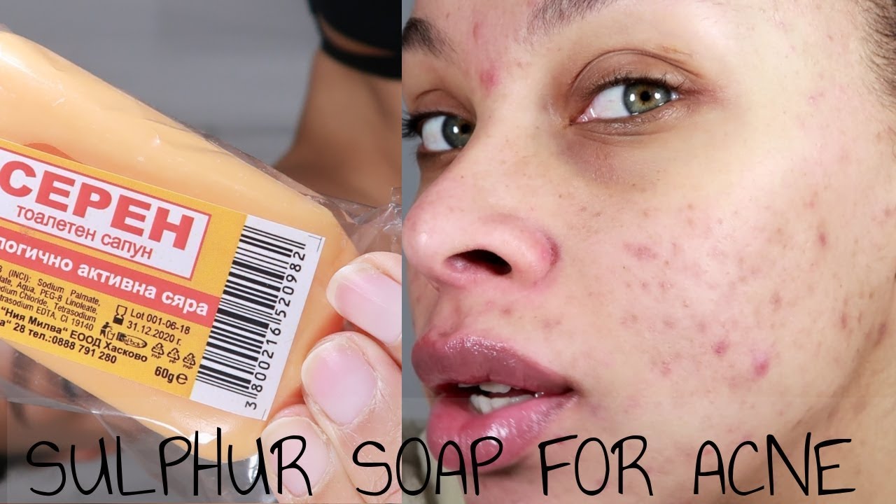 benefits of sulfur soaps 