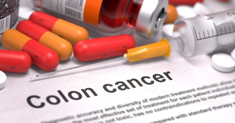 What Everyone Must Know About Colon Cancer