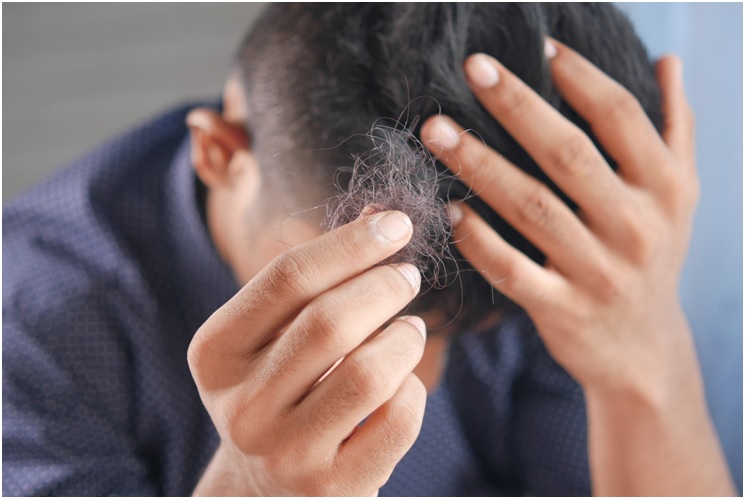 What are the Effects of Testosterone on Hair Loss?