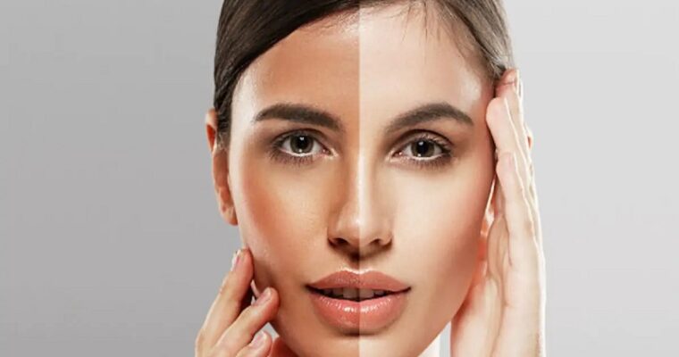 Skin Whitening Secrets You Should Try