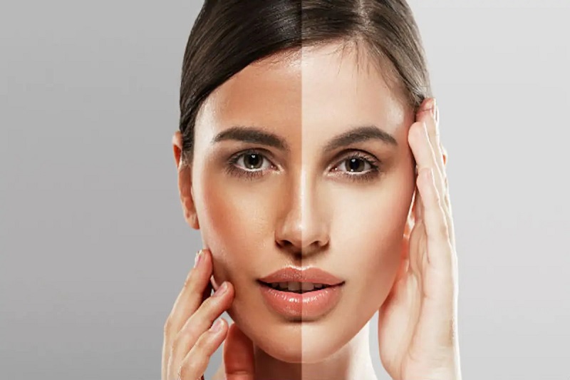Skin Whitening Secrets You Should Try