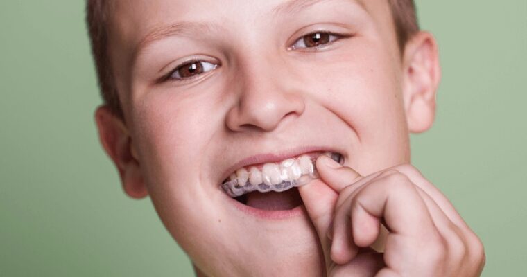 Everything You Need To Know About Invisalign for Teenagers