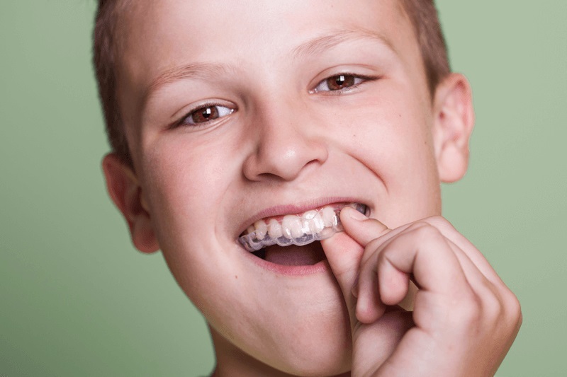 Everything You Need To Know About Invisalign for Teenagers