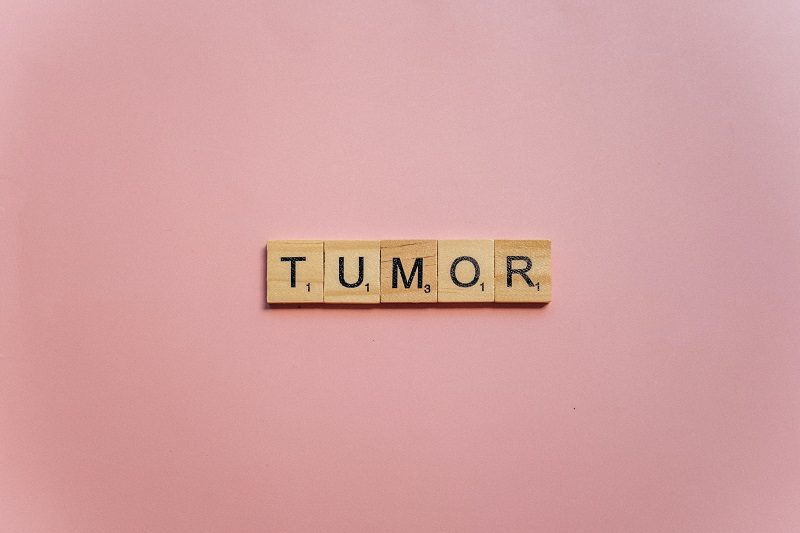 Detailed Guide About the Types of Tumors