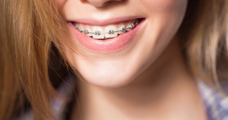 4 Top Questions You Might Have About Orthodontists