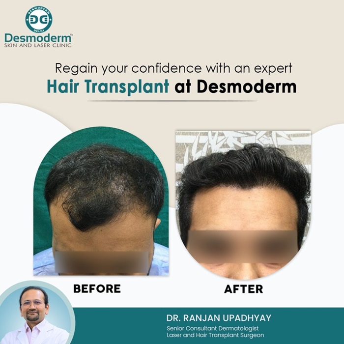 9 Signs a Hair Transplant Clinic May Not Be Right for You