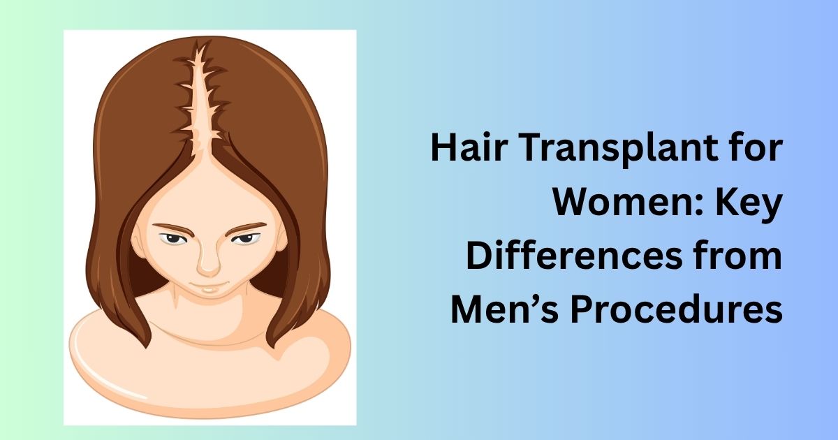 Hair Transplant for Women: Key Differences from Men’s Procedures